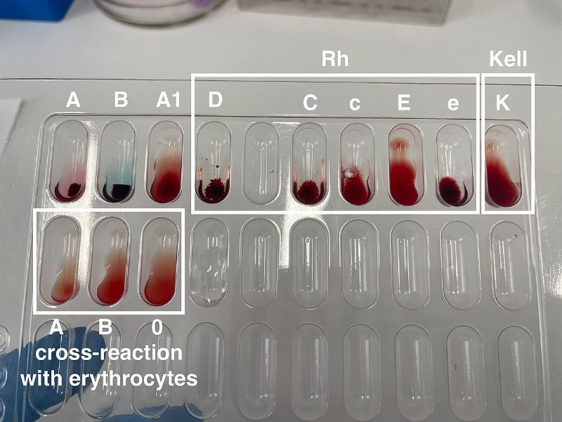 Understanding Common Blood Tests